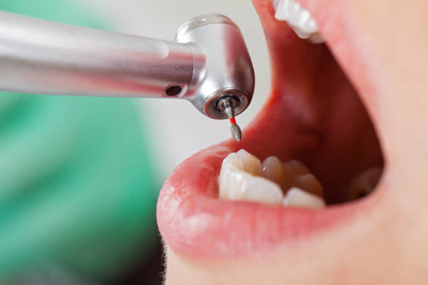 Best Emergency Dental Services for Seniors in Elma, WA